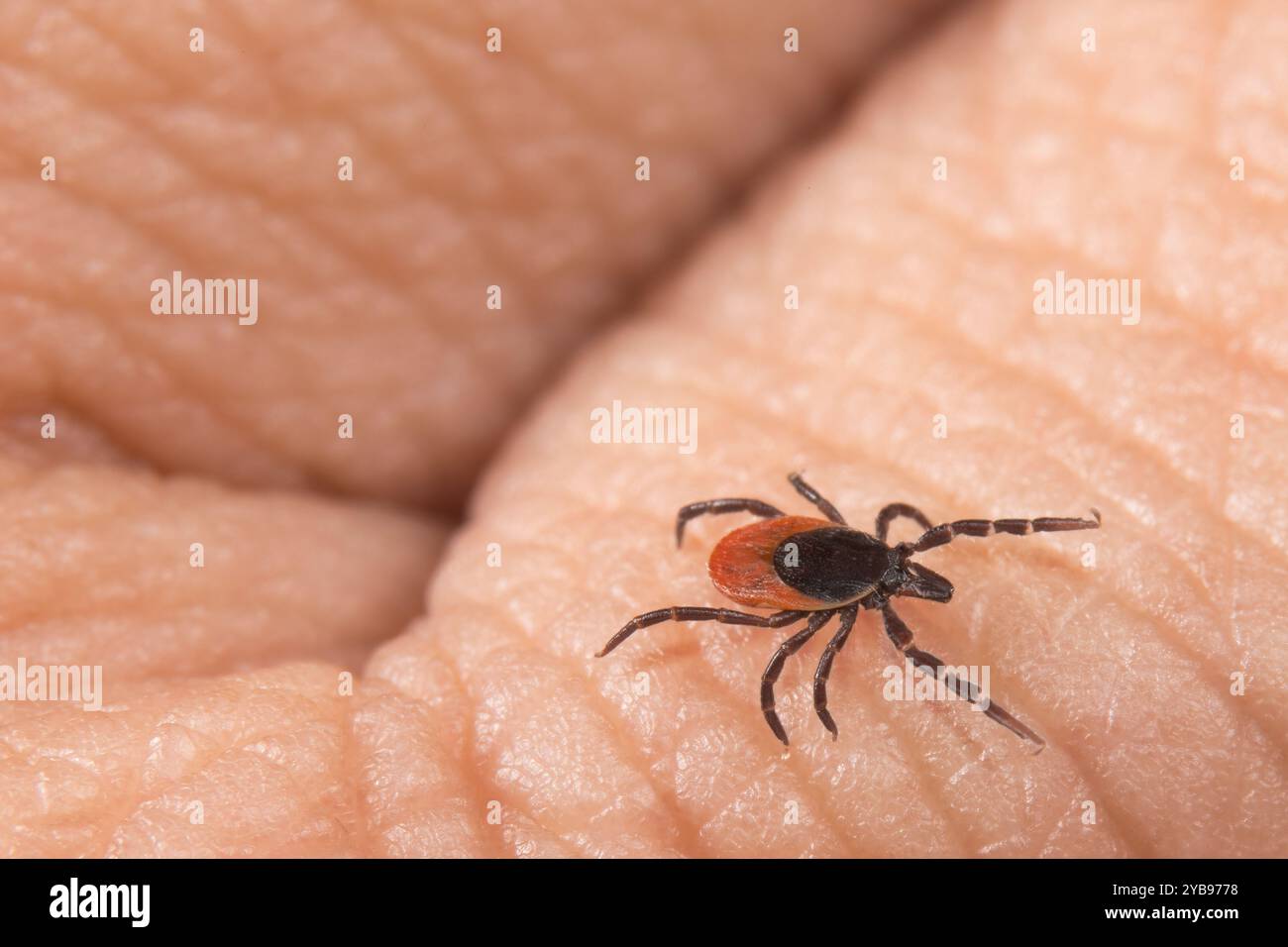 Weibliche Hirschzeckenparasitin krabbelt auf einem menschlichen Finger-Hauthintergrund. Gefahr der Übertragung von Zeckenerkrankungen als Enzephalitis und Lyme-Borreliose. Stockfoto