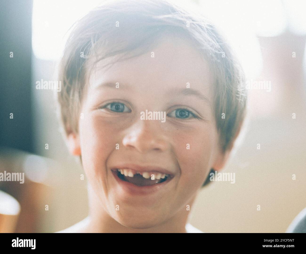 Junge mit einer Zahnlücke Stockfoto