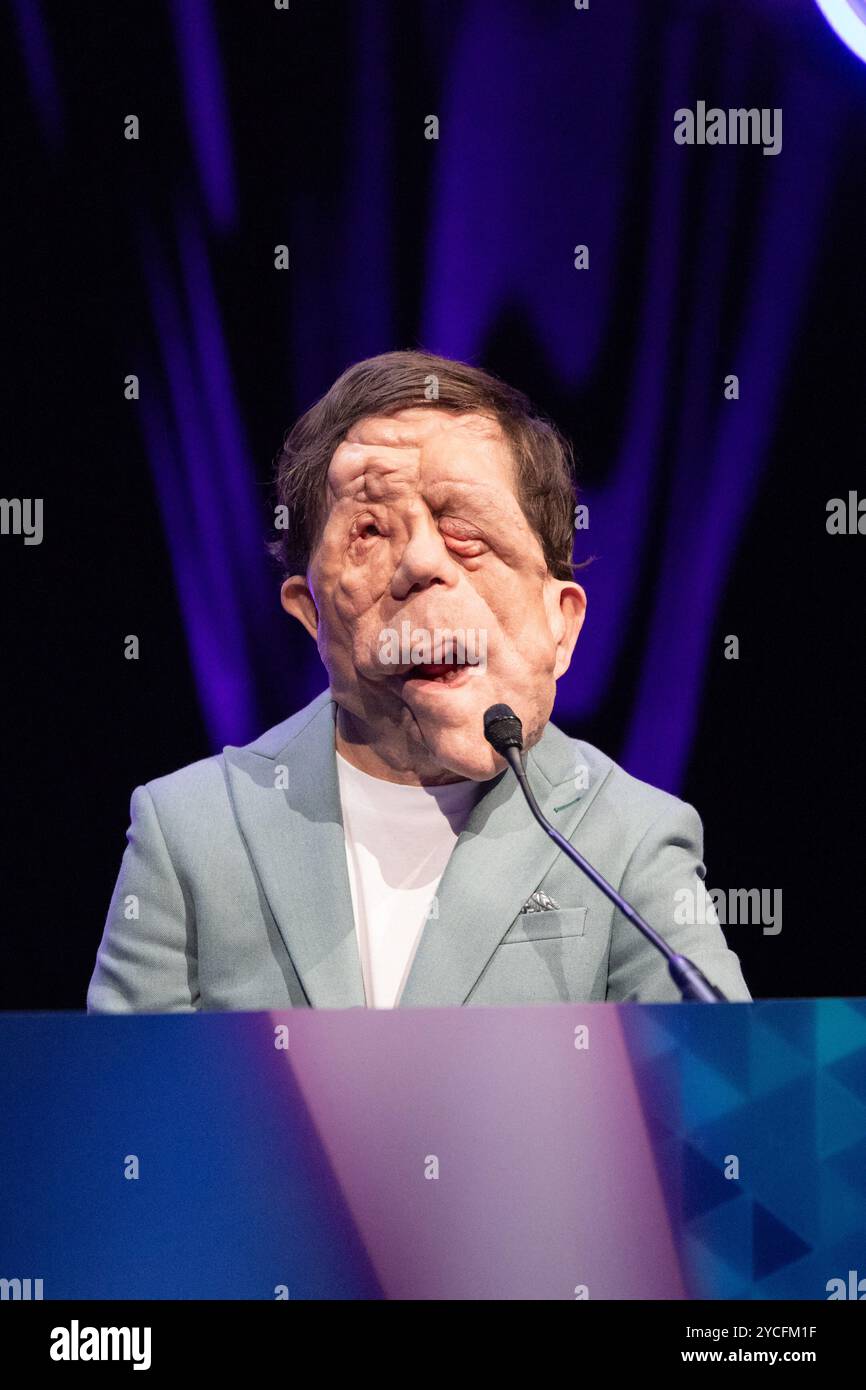 Cannes, Frankreich. Oktober 2024. Adam Pearson nimmt am 22. Oktober 2024 an den Diversify TV Awards im Rahmen der MIPCOM 2024 in Cannes Teil. Foto von Shootpix/ABACAPRESS. COM Credit: Abaca Press/Alamy Live News Stockfoto