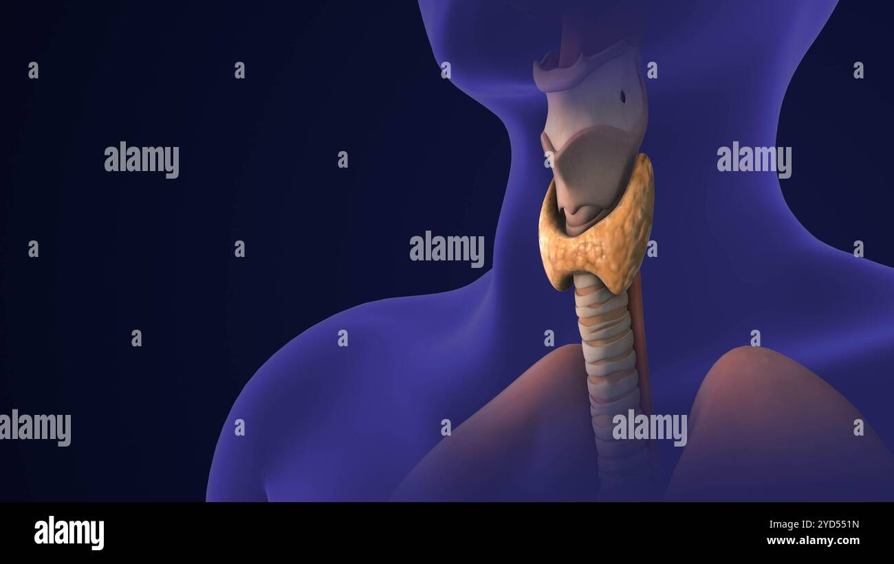 Das medizinische Konzept des Schilddrüsenkarzinoms Stockfoto