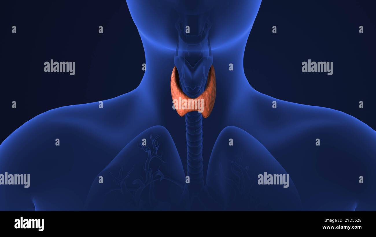Medizinische Animation des Schilddrüsenkarzinoms Stockfoto