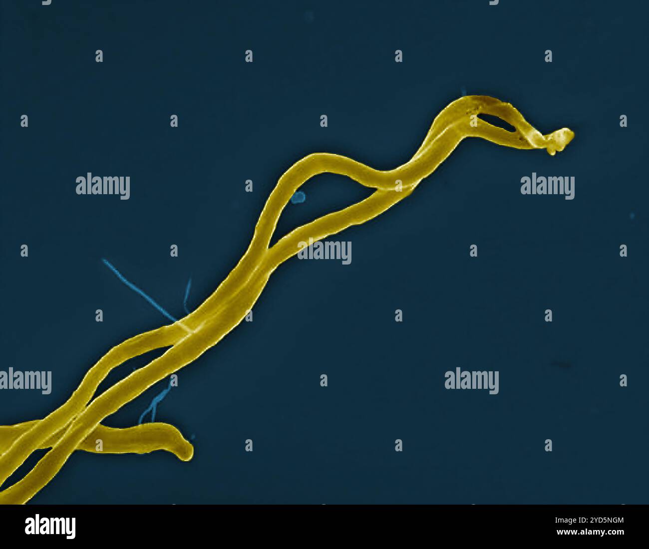 Borrelia burgdorferi Bakterien (gefärbtes Gold), die Lyme-Borreliose durch den Biss einer infizierten Zecke verursachen können. Stockfoto