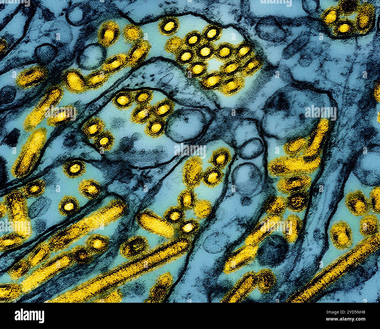 Kolorierte Transmissionselektronenmikrographie von Viruspartikeln der Aviären Influenza A H5N1 (gelb). Stockfoto