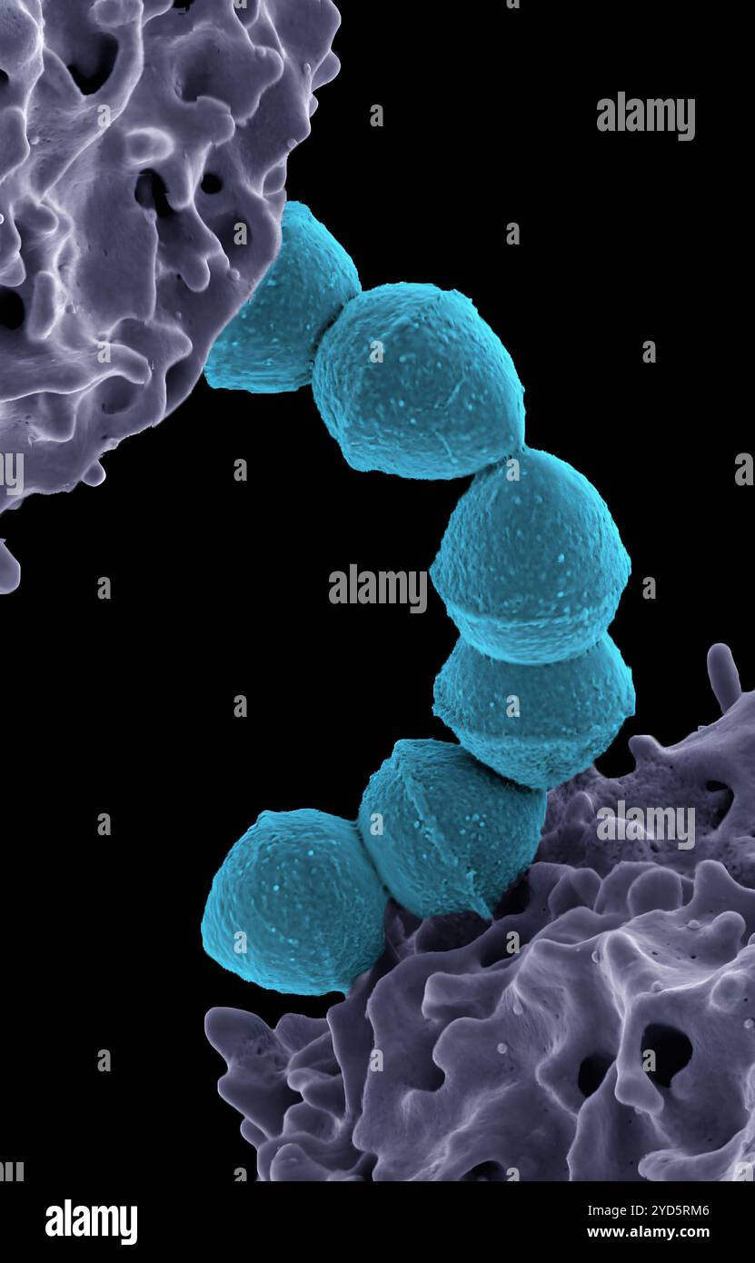 Colorierte Rasterelektronenmikroskopie von Streptokokken der Gruppe A (Streptococcus pyogenes) Bakterien (Petrol) und einer humanen Neutrophile (Purple). Stockfoto