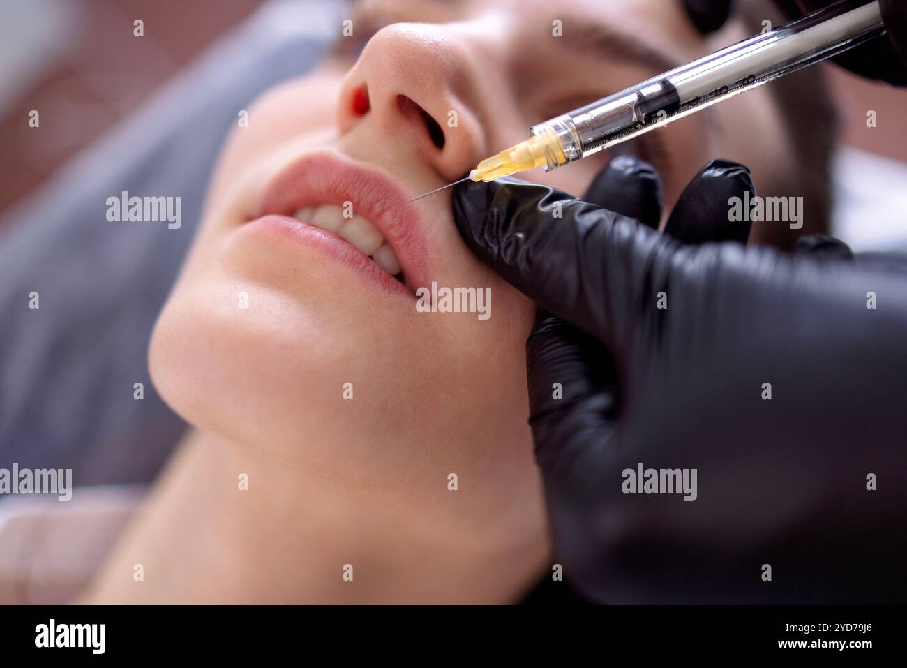 Beauty-Injektionen. Eine Kosmetikerin in schwarzen Handschuhen spritzt sich Stockfoto
