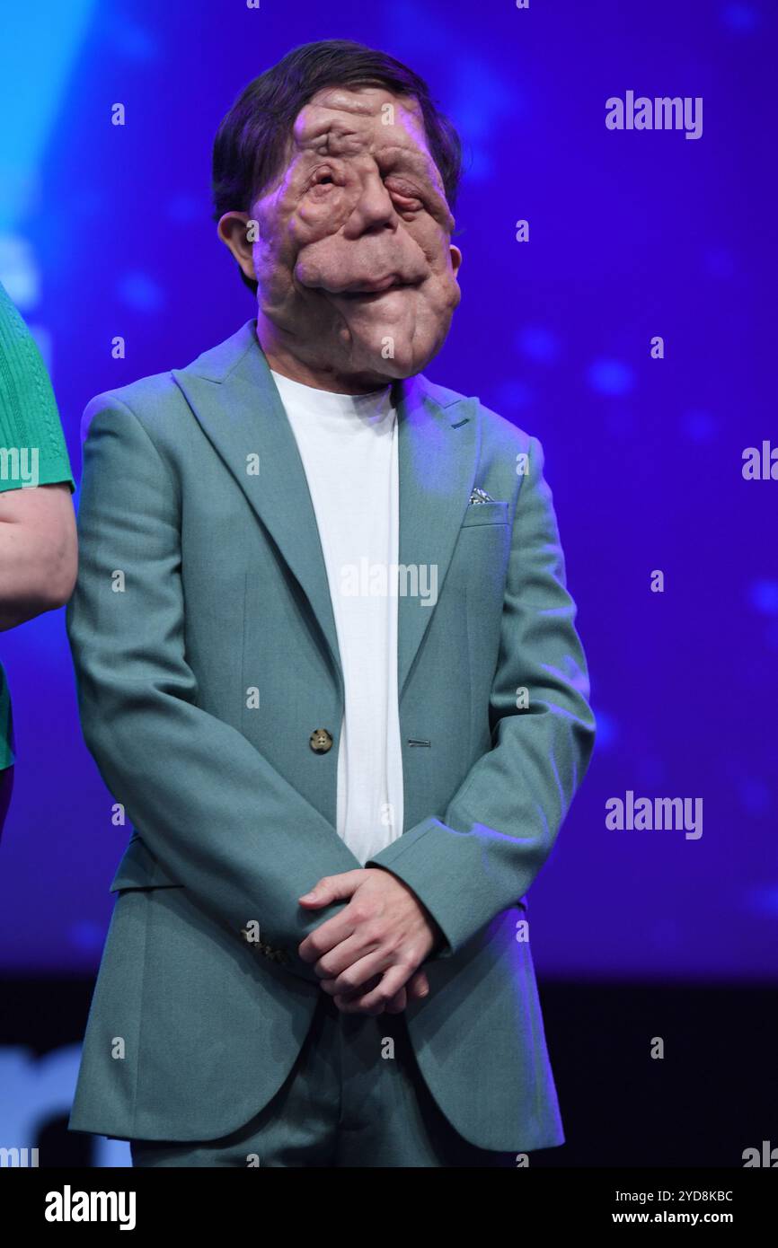 Cannes, Frankreich. Oktober 2024. Adam Pearson nimmt an den Diversify TV Awards während des MIPCOM Cannes 2024 Teil. (Foto: Luigi Lorio/SOPA Images/SIPA USA) Credit: SIPA USA/Alamy Live News Stockfoto