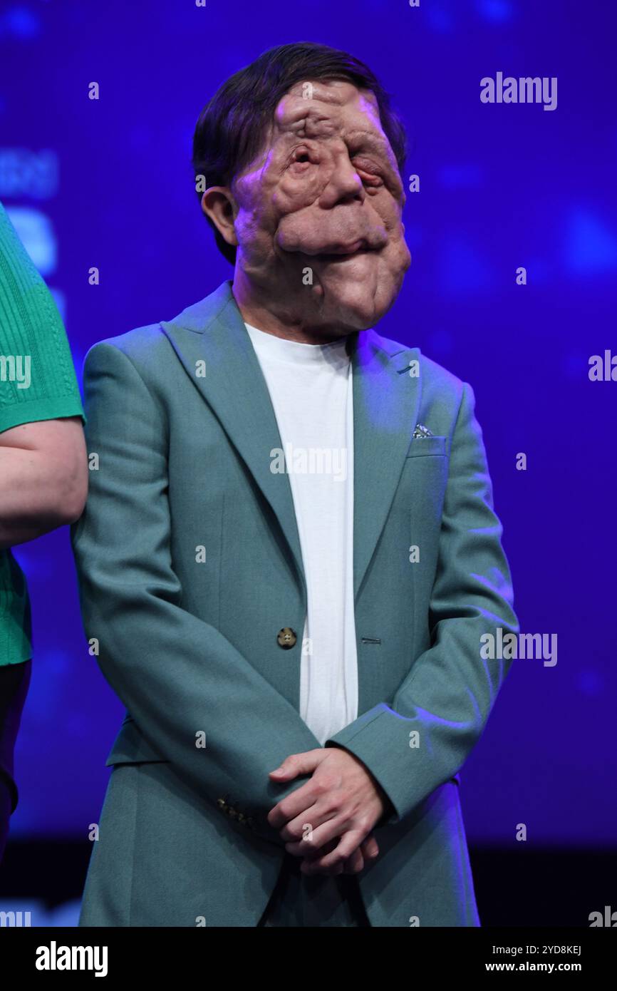 Cannes, Frankreich. Oktober 2024. Adam Pearson nimmt an den Diversify TV Awards während des MIPCOM Cannes 2024 Teil. (Foto: Luigi Lorio/SOPA Images/SIPA USA) Credit: SIPA USA/Alamy Live News Stockfoto