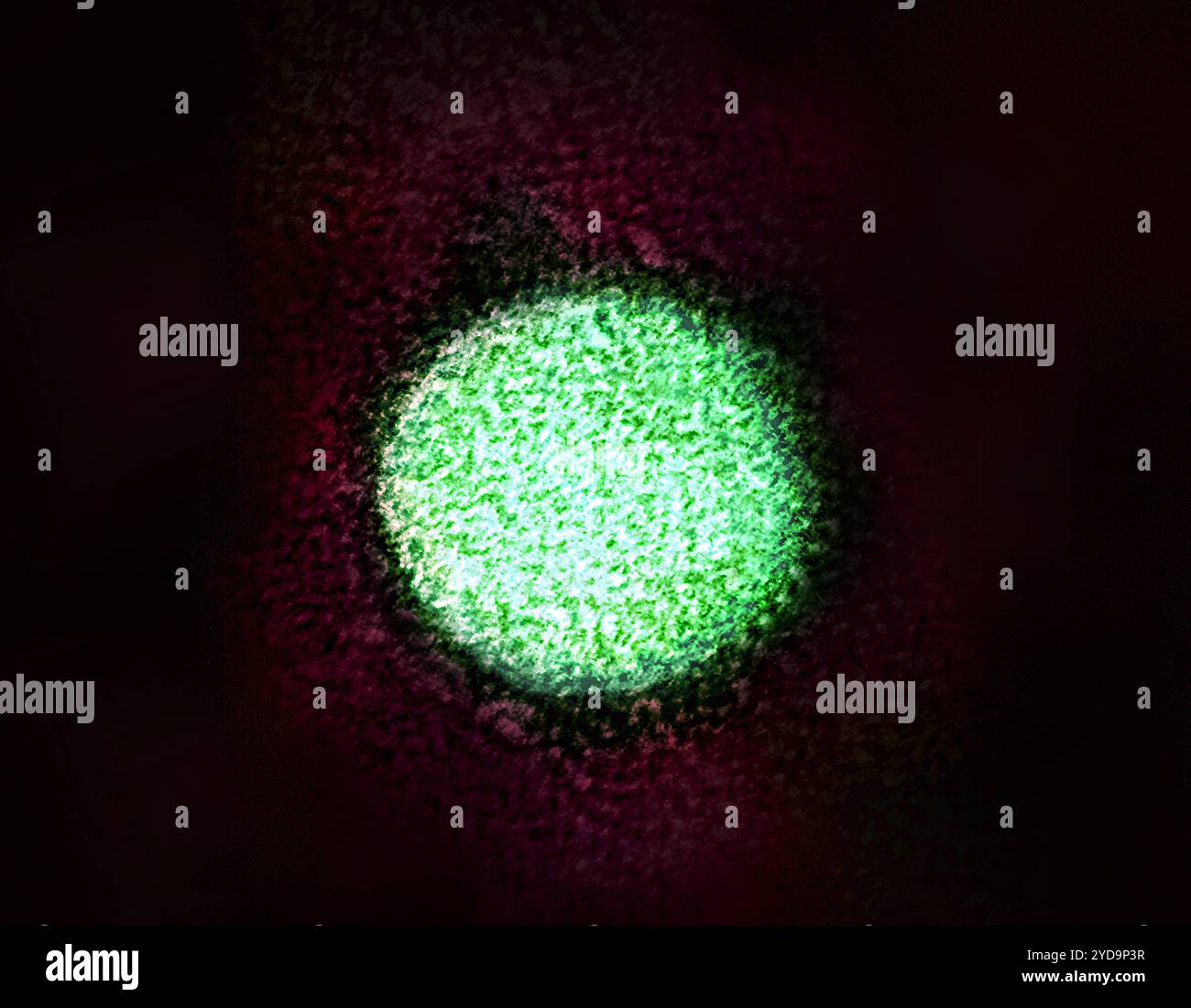 Koloriertes Transmissionselektronenmikroskop eines Hepatitis-C-Virions. Hepatitis C 016867_059 Stockfoto