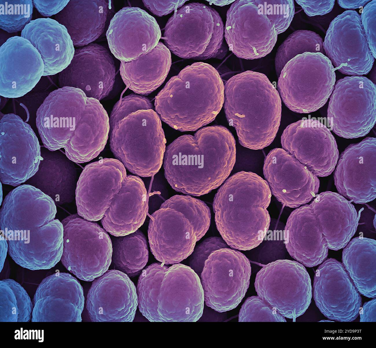 Rasterelektronenmikroskopische Darstellung von Neisseria gonorrhoeae-Bakterien, die Gonorrhoe verursachen. Neisseria gonorrhoeae-Bakterien 016867 063 Stockfoto