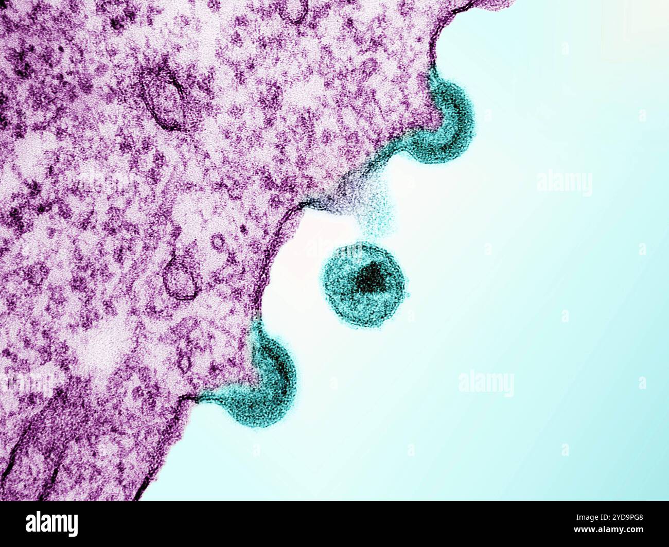 Transmissionselektronenmikroskop von HIV-1-Viruspartikeln Petrol aus infizierten H9-Zellen, hergestellt in Zellkultur. Die Partikel weisen zwei Stadien der Replikation auf: Die beiden Lichtbögen sind unreife Partikel, die aus der Plasmamembran der Zelle hervorgehen, und das zentrische kugelförmige Teilchen ist eine reife Form im extrazellulären Raum. HIV-1 Viruspartikel 016867 089 Stockfoto