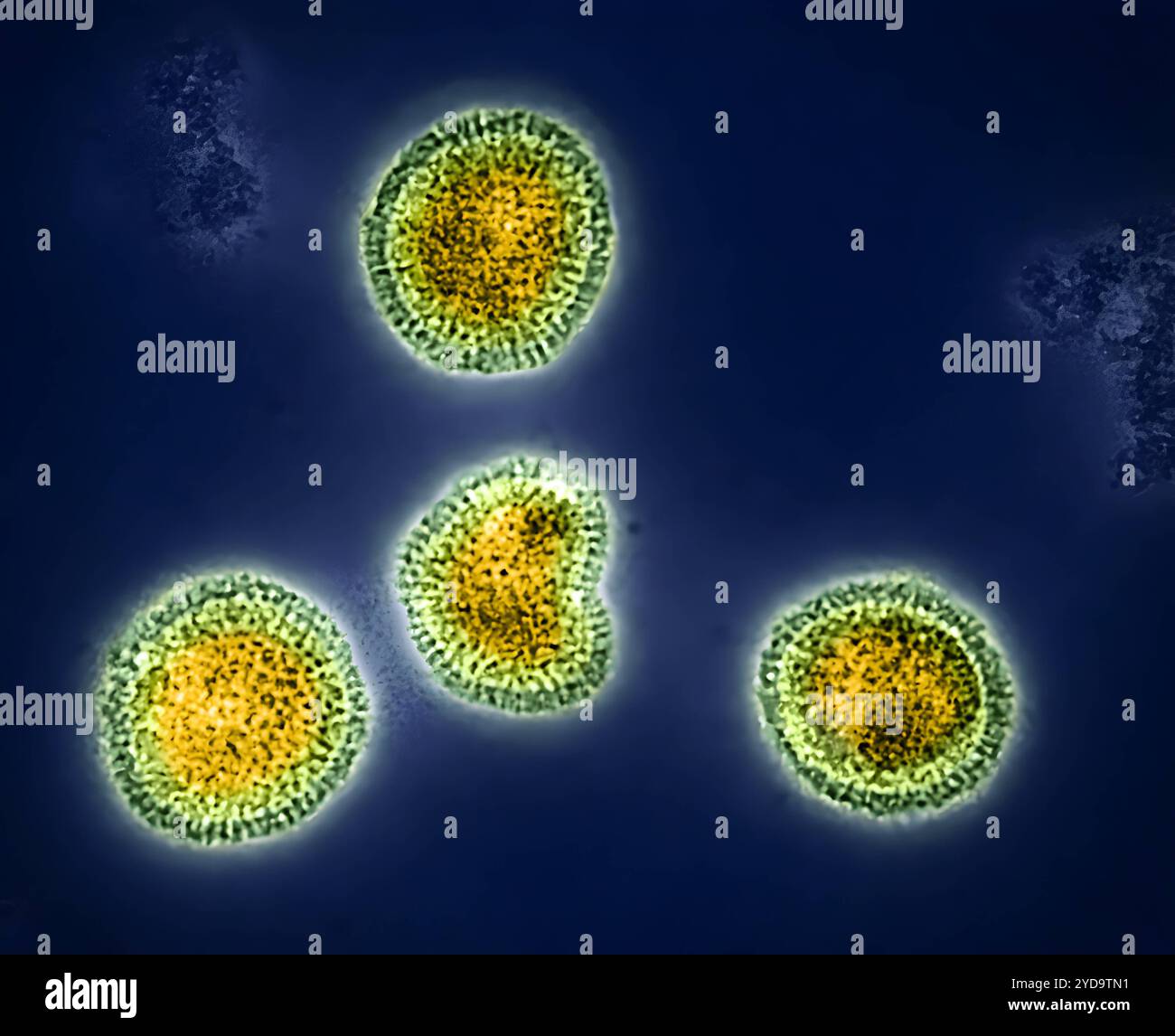 Influenza-B-Viruspartikel, gelb und grün gefärbt, aus einer Patientenprobe isoliert und dann in Zellkultur vermehrt. Sowohl Influenza A als auch B können saisonale Grippe verursachen, im Gegensatz zum Influenza A-Virus, das auch Tiere infizieren kann, infiziert Influenza B nur den Menschen. Influenza-B-Virus 016867_319 Stockfoto
