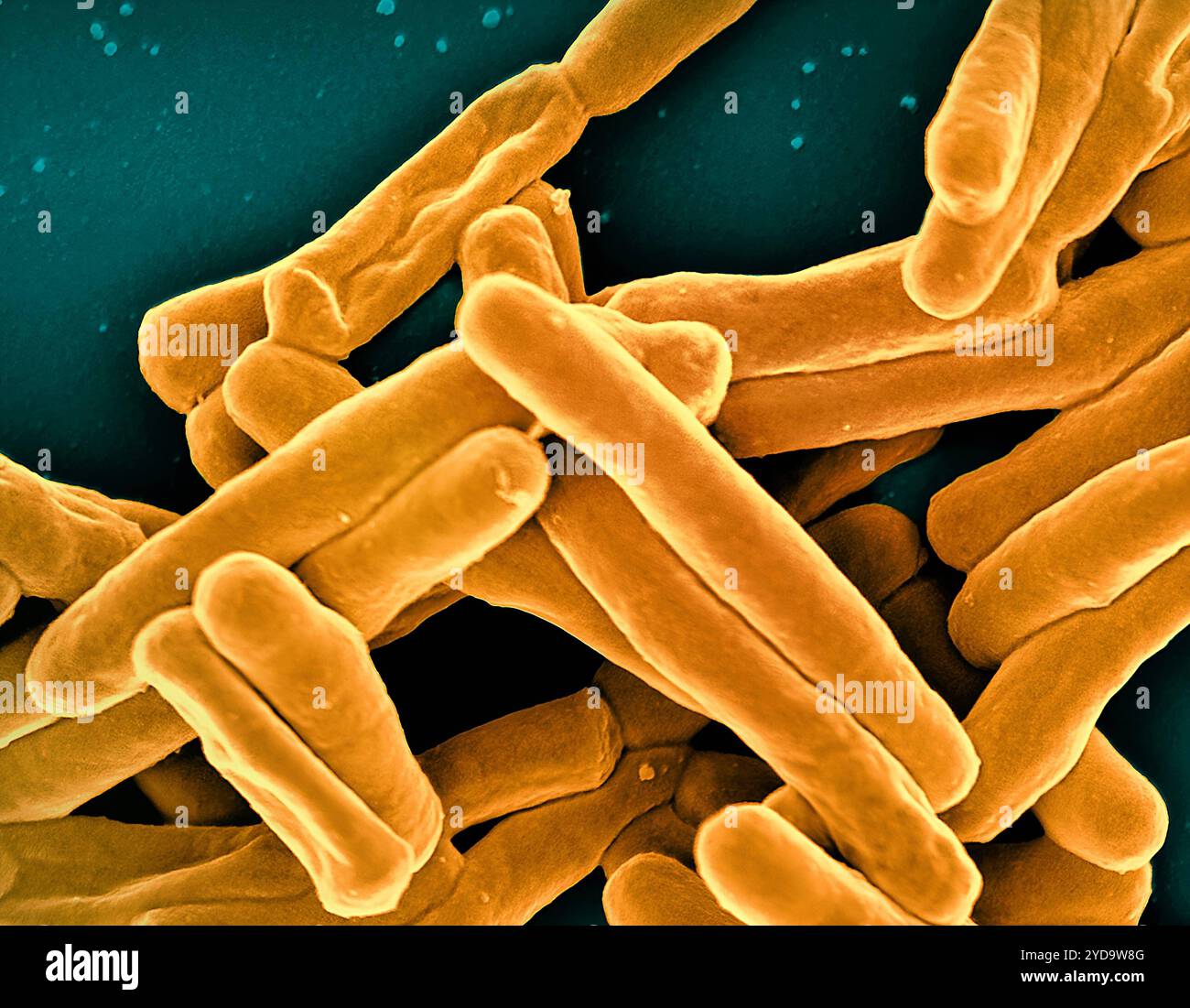 Rasterelektronenmikroskopische Darstellung von Mycobacterium tuberculosis-Partikeln färbte Gold, das TB-verursachende Bakterium. Mycobacterium Tuberculosis-Bakterien 016867 398 Stockfoto