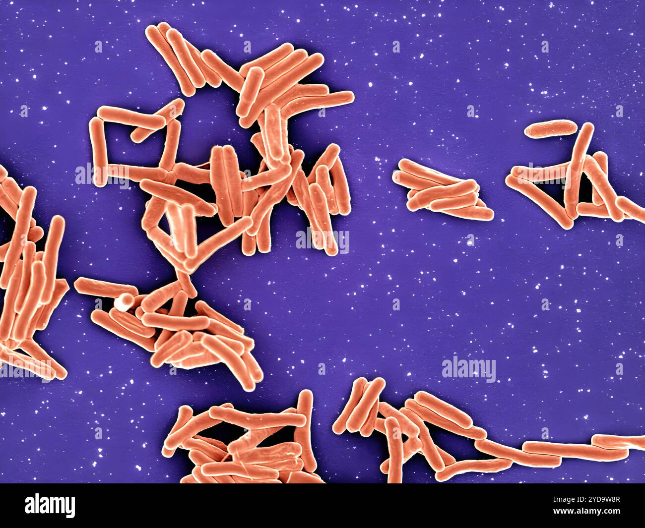 Rasterelektronenmikroskopische Darstellung von Mycobacterium tuberculosis-Partikeln, die orange gefärbt sind, das TB-verursachende Bakterium. Mycobacterium Tuberculosis-Bakterien 016867 396 Stockfoto