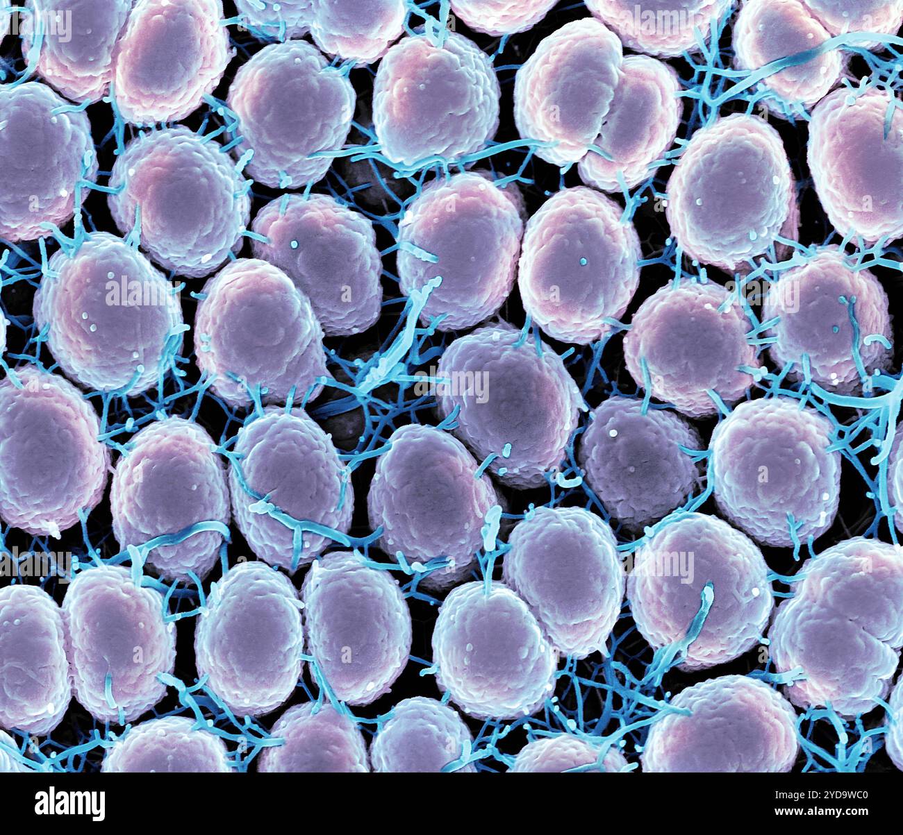 Rasterelektronenmikroskopische Darstellung von Neisseria gonorrhoeae-Bakterien, die Gonorrhoe verursachen. Neisseria gonorrhoeae-Bakterien 016867 415 Stockfoto