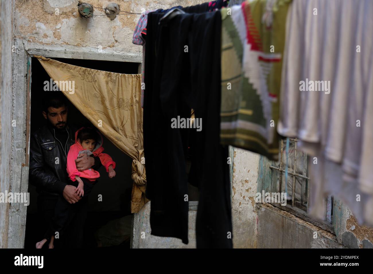 Rawan Amer Nasser ist ein achtjähriges Kind aus der Stadt Meda&#8217;ani in der Region al-Maraj im Osten von Ghouta. Vor zwei Jahren, als das syrische Regime die Kontrolle über Meda&#8217;ani übernahm, flohen Rawan und ihre Familie in die Stadt Hammouriya im Osten von Ghouta. Rawan leidet an Zerebralparese, die durch eine intrakranielle Blutung verursacht wurde, an Niereninsuffizienz und schwerer Mangelernährung. Sie muss dringend evakuiert werden, um eine angemessene Behandlung zu erhalten, da in Ost-Ghouta keine geeignete Behandlung verfügbar ist Stockfoto