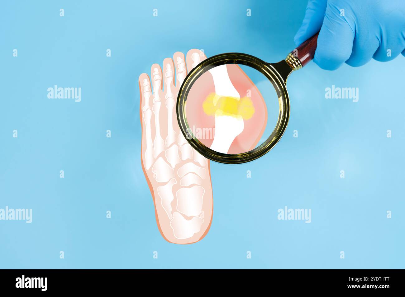 Menschliches Fußskelett, gesehen durch eine oben isolierte Lupe. Medizinische Illustration für die Ausbildung. Gichtkonzept. Nahaufnahme des Gelenks mit Inflam Stockfoto