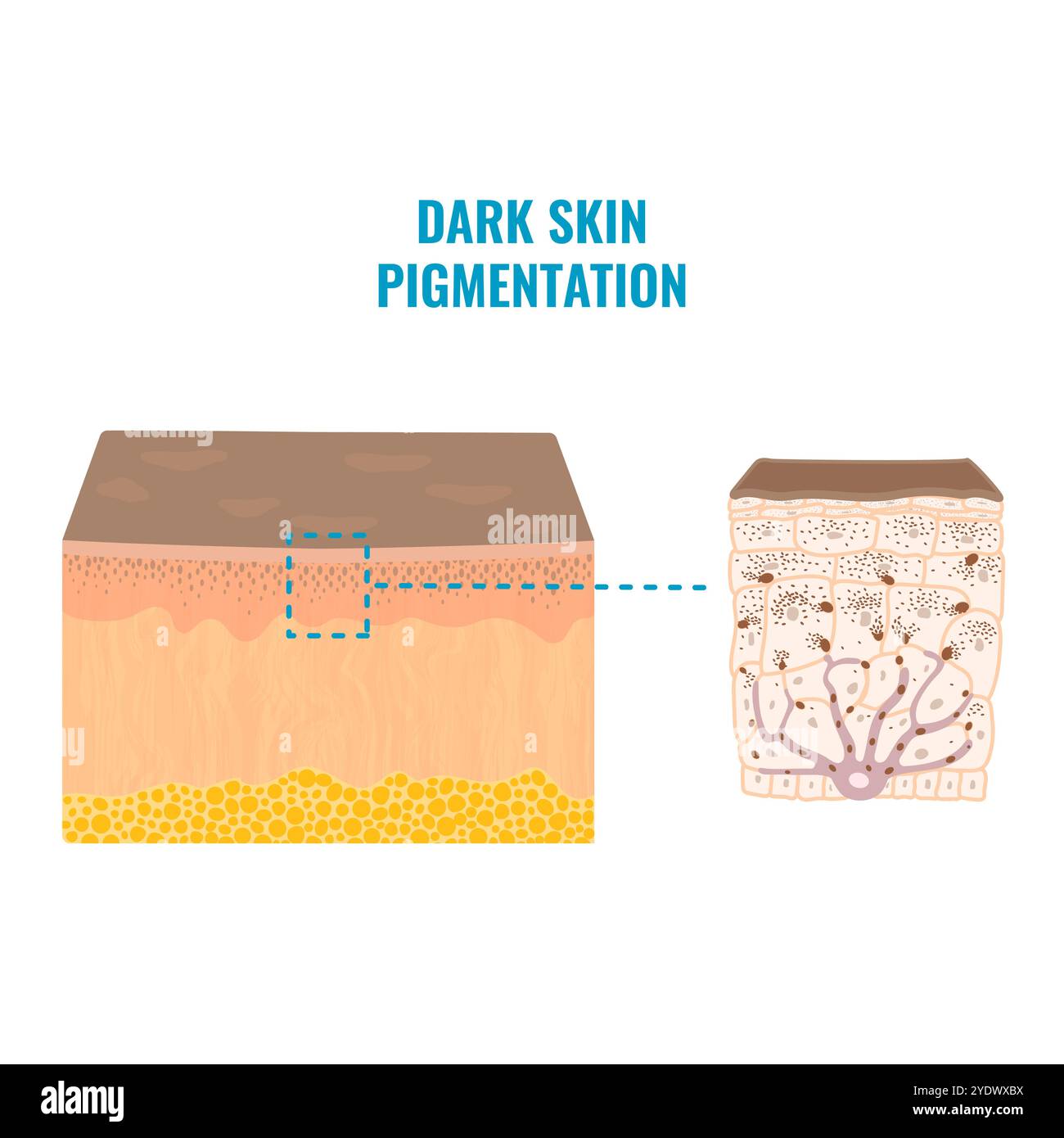 Der Hauttonpigmentierungsmechanismus bei dunkler Haut Stock Vektor