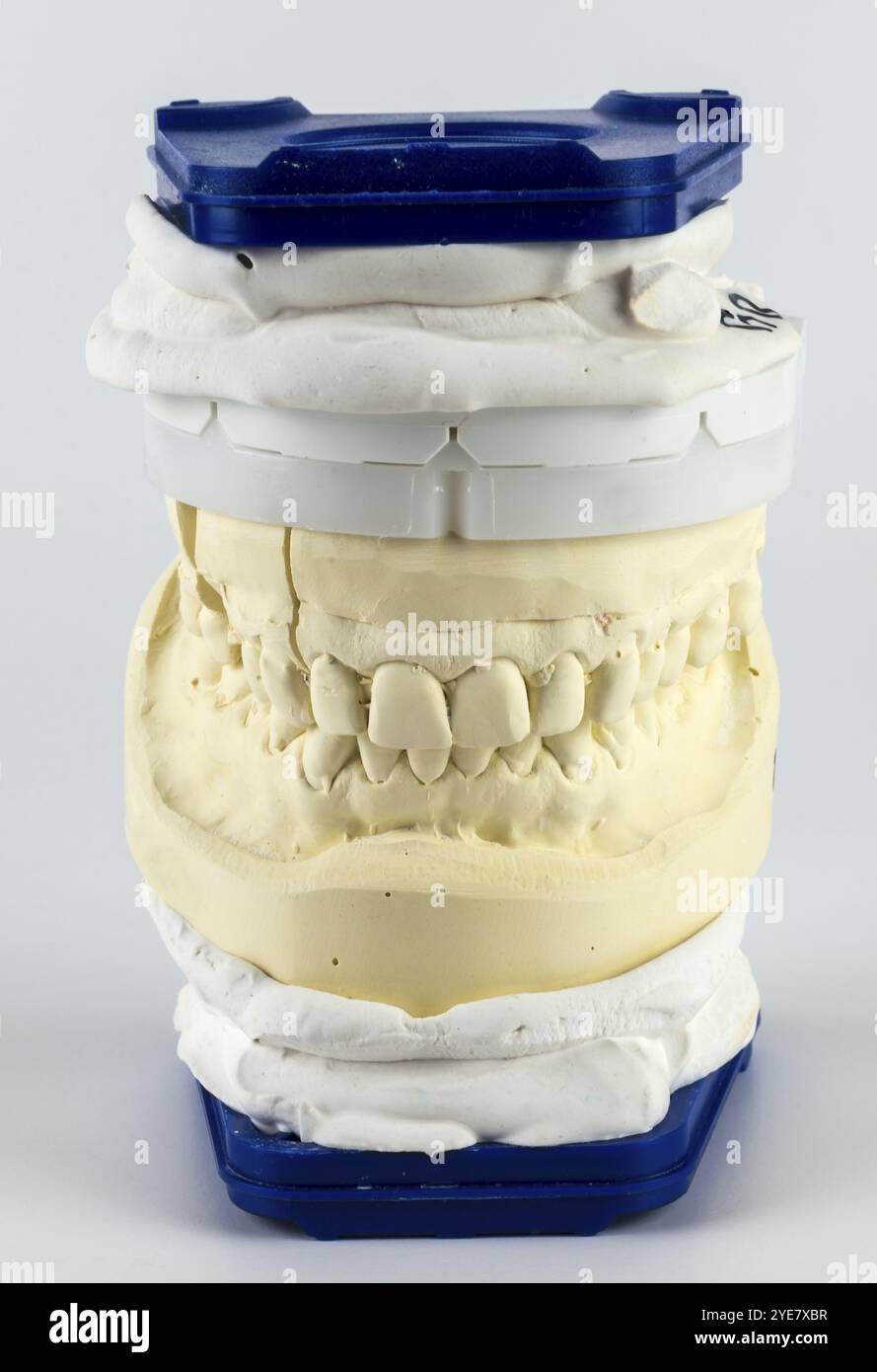 Vertikales Dentalmodell in blau und weiß, zeigt Ober- und Unterkiefer aus Gips im Detail Stockfoto