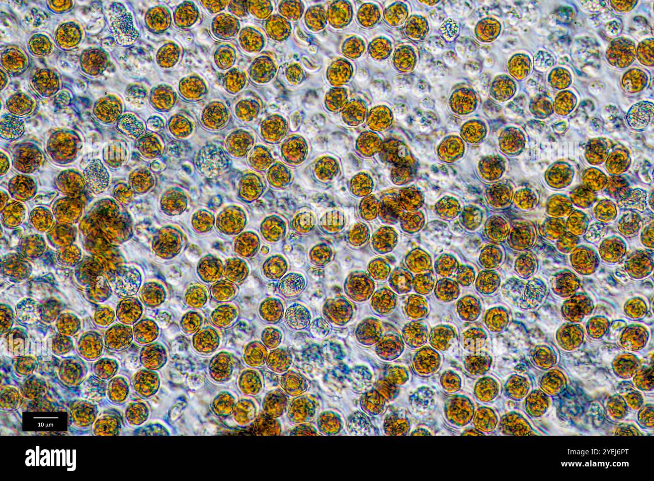 Symbiotische Algen (Zooxanthellen, Cladocopium sp.) Extrahiert aus der Weichkoralle Capnella imbricata (Alcyonacea, Nephtheidae). Stockfoto