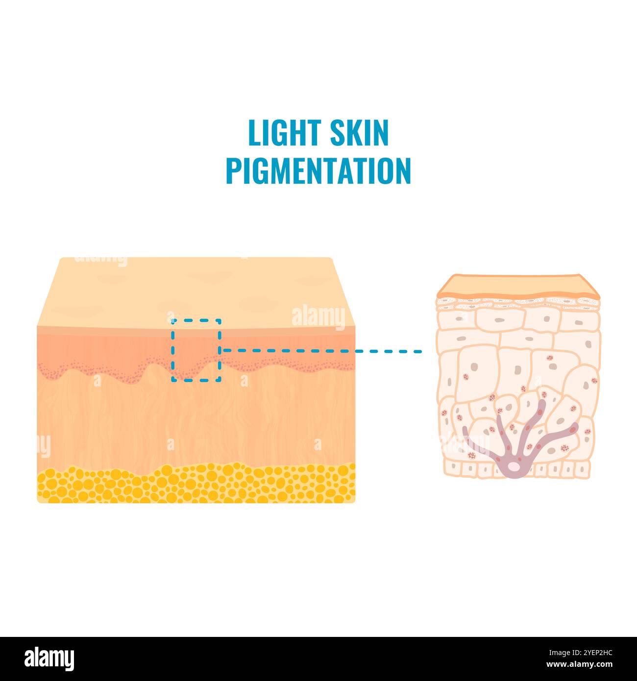 Heller Hautton Pigmentmechanismus medizinisch Stock Vektor