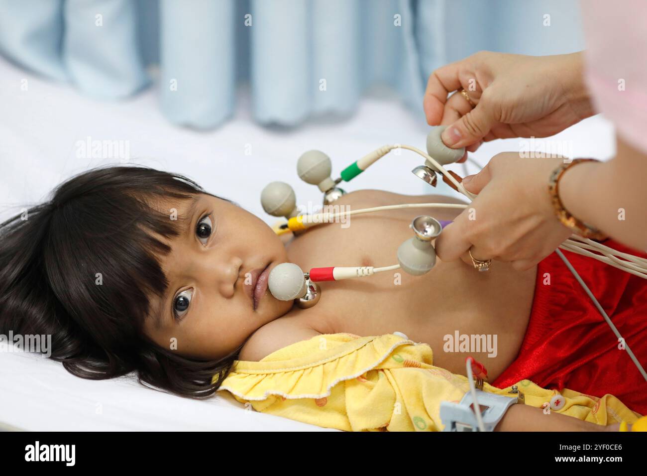 Krankenhaus. Kindliche Leiden angeborener Herzerkrankungen. Ho-Chi-Minh-Stadt. Vietnam. Stockfoto