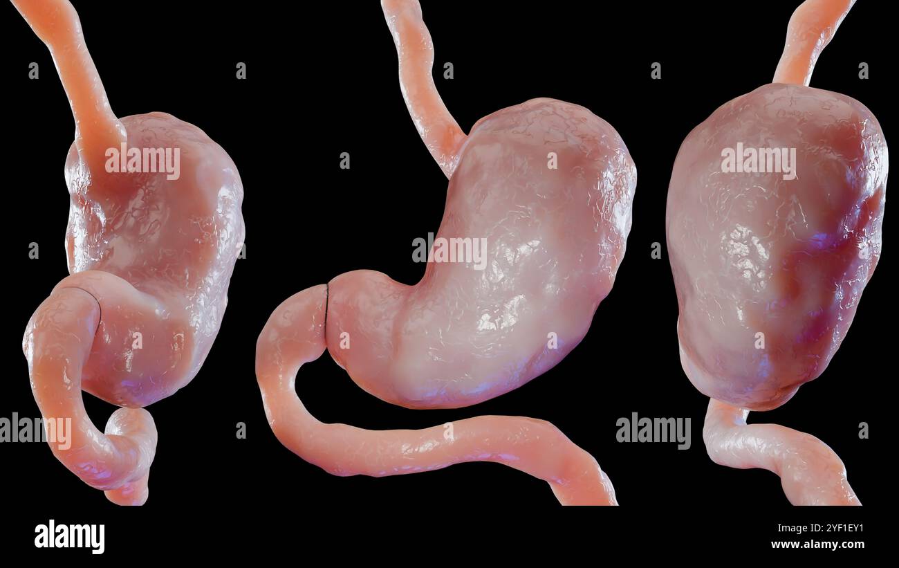 Menschlicher Magen Anatomie Verdauung, Ösophagus Abdomen Magen mit saurem Verdauungstrakt, Magenwandkontraktion, internes Organ, Magendarm, Prozess der Brea Stockfoto