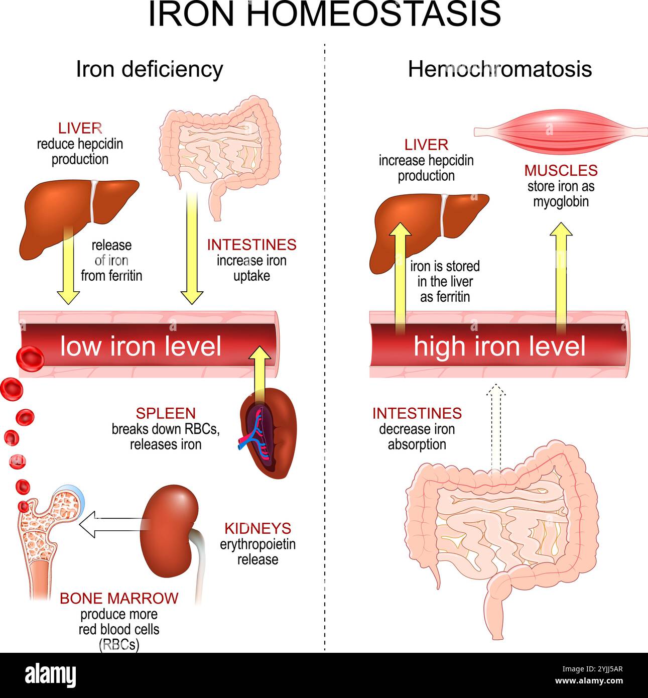 Eisenhomöostase. Hämochromatose und Eisenmangelanämie. Normale Eisenspiegel im Blut. Vektorposter Stock Vektor