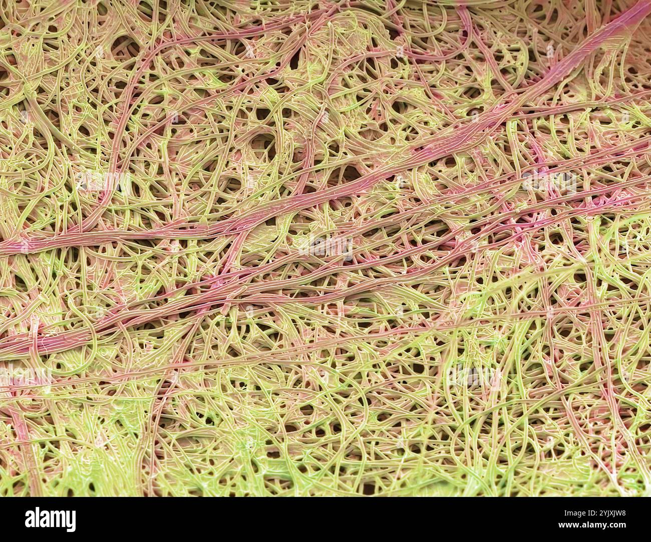 Spinnenseidenstränge. Farbige Rasterelektronenmikrographie (REM) von Seidensträngen aus gefangener Insektenbeute. Seide wird auch von vielen Spinnen verwendet, um Eierkästen herzustellen. Spinnenseide besteht aus einem Proteinpolymer namens Fibroin. Er ist sehr elastisch und kann 30-40 Prozent seiner Länge gedehnt werden, bevor er bricht. Vergrößerung: x1000 bei Druck von 10 cm Breite Stockfoto