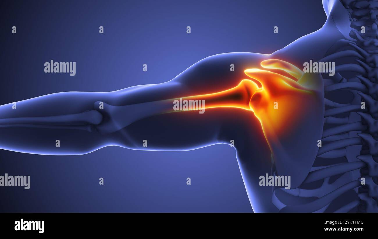 Animation mit menschlichem Schulterbeschwerden Stockfoto