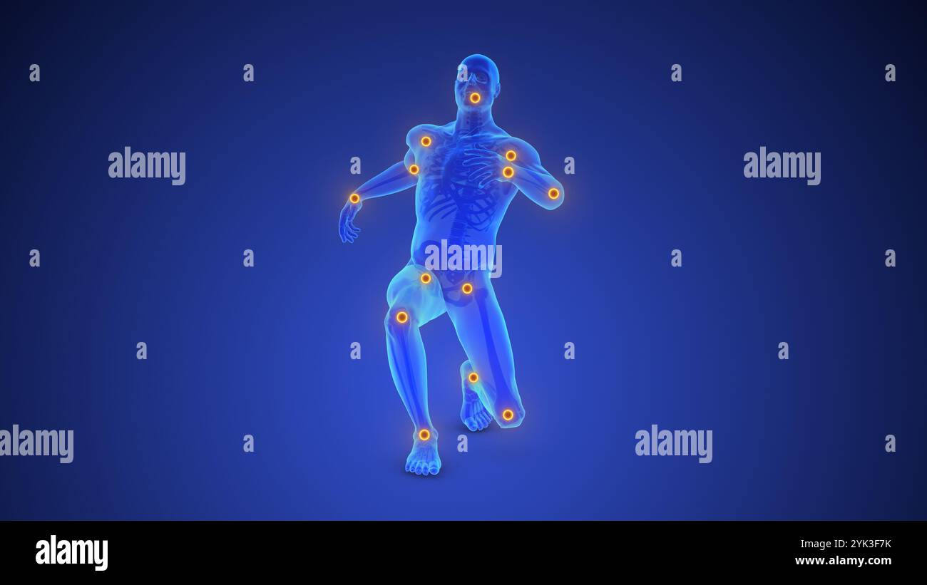 Chronische Schmerzen bei Mehrkörpergelenken Stockfoto