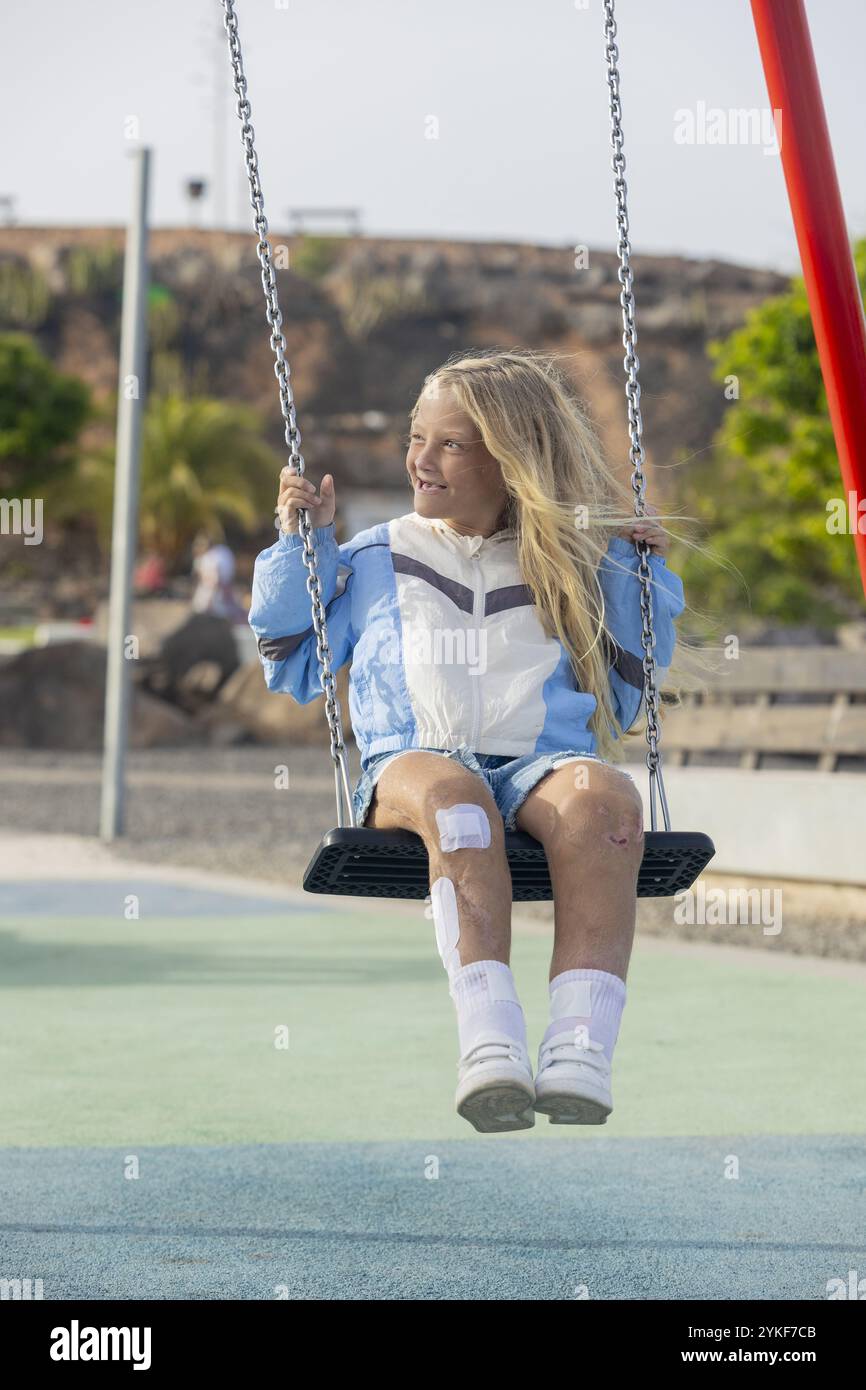 Eine fröhliche junge Frau mit Stuve-Wiedemann-Syndrom, die medizinische Flecken und Narben trägt, genießt ihre Zeit auf einer Spielplatzschaukel und zeigt ihre Widerstandsfähigkeit Stockfoto