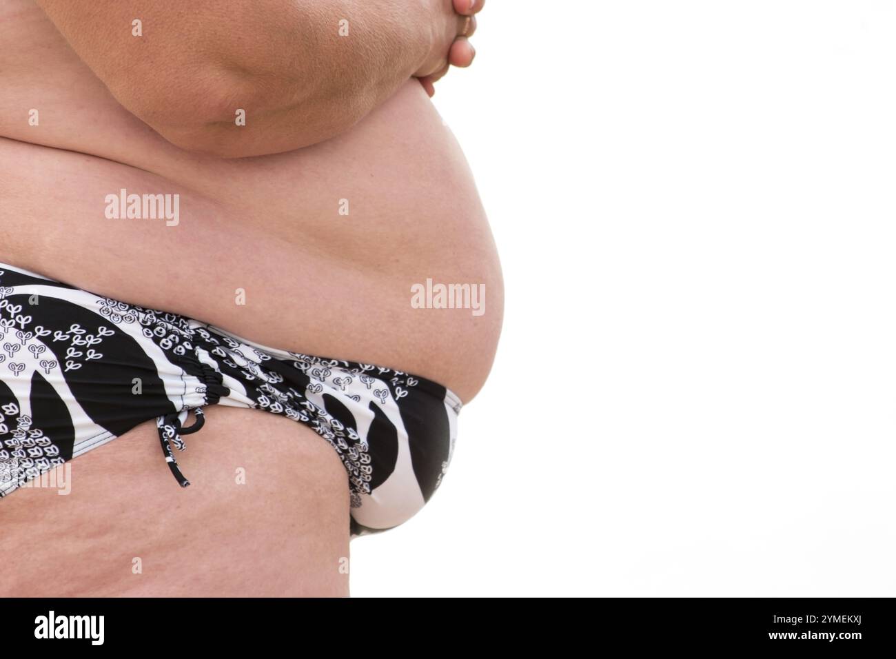 Der Bauch einer fetten Frau. Adipöser Körper isoliert. Die Gesundheit ist in Gefahr. Nachwirkungen des Überessens Stockfoto