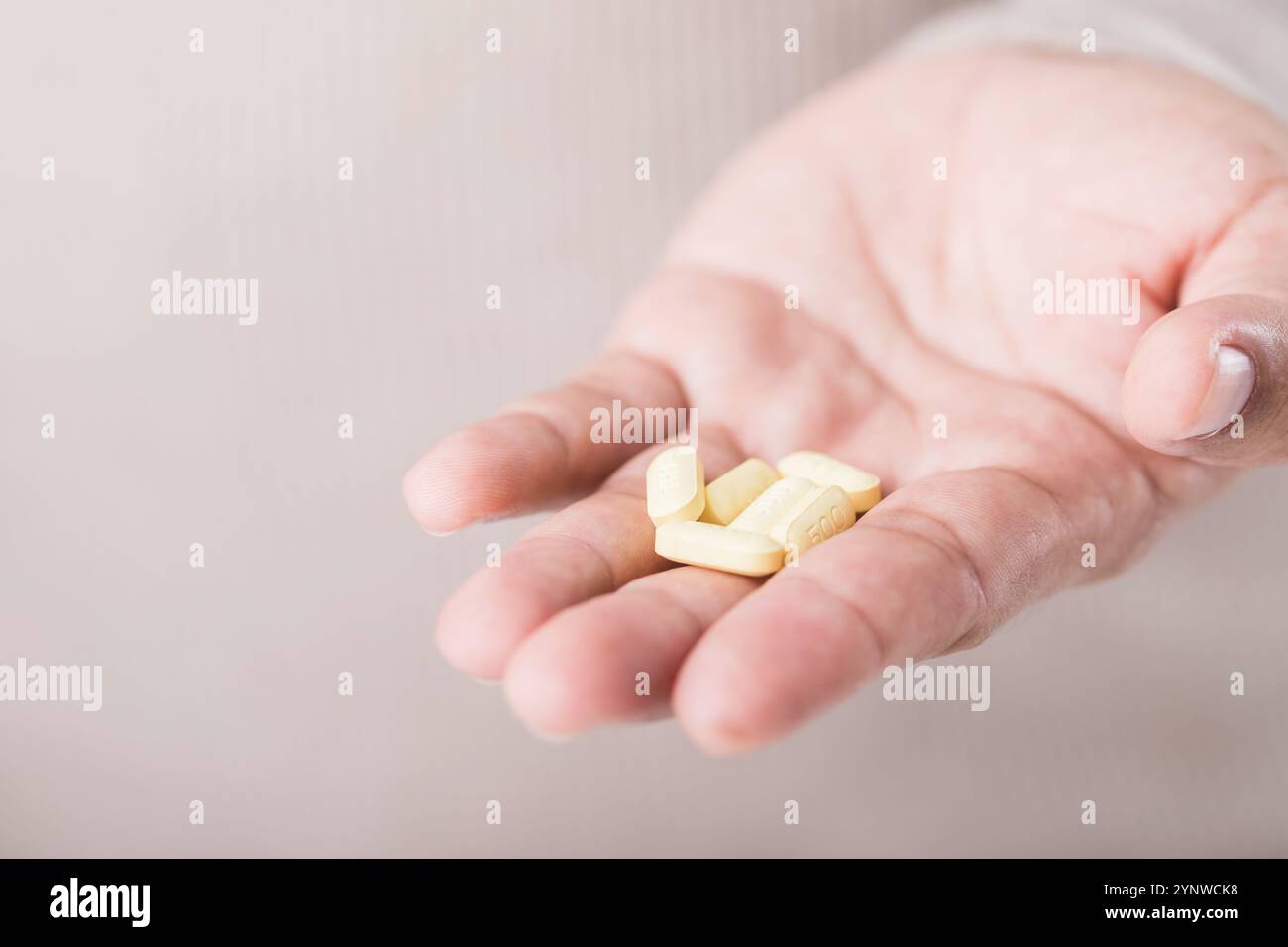 Der Mann hält mehrere gelbe Pillen in der Hand, was das Risiko einer Überdosierung über die vorgeschriebenen Grenzwerte hinweist. Dieses Bild unterstreicht die Bedeutung von Foll Stockfoto