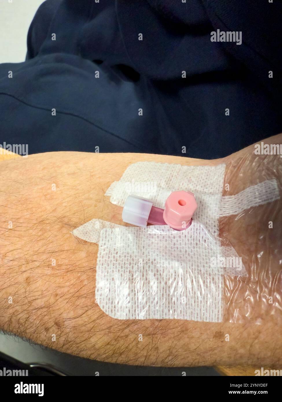 Eine Kanüle, die in den Arm eines älteren Mannes eingeführt wurde: Phillip Roberts - Smartphone-aufgenommenes Stockfoto