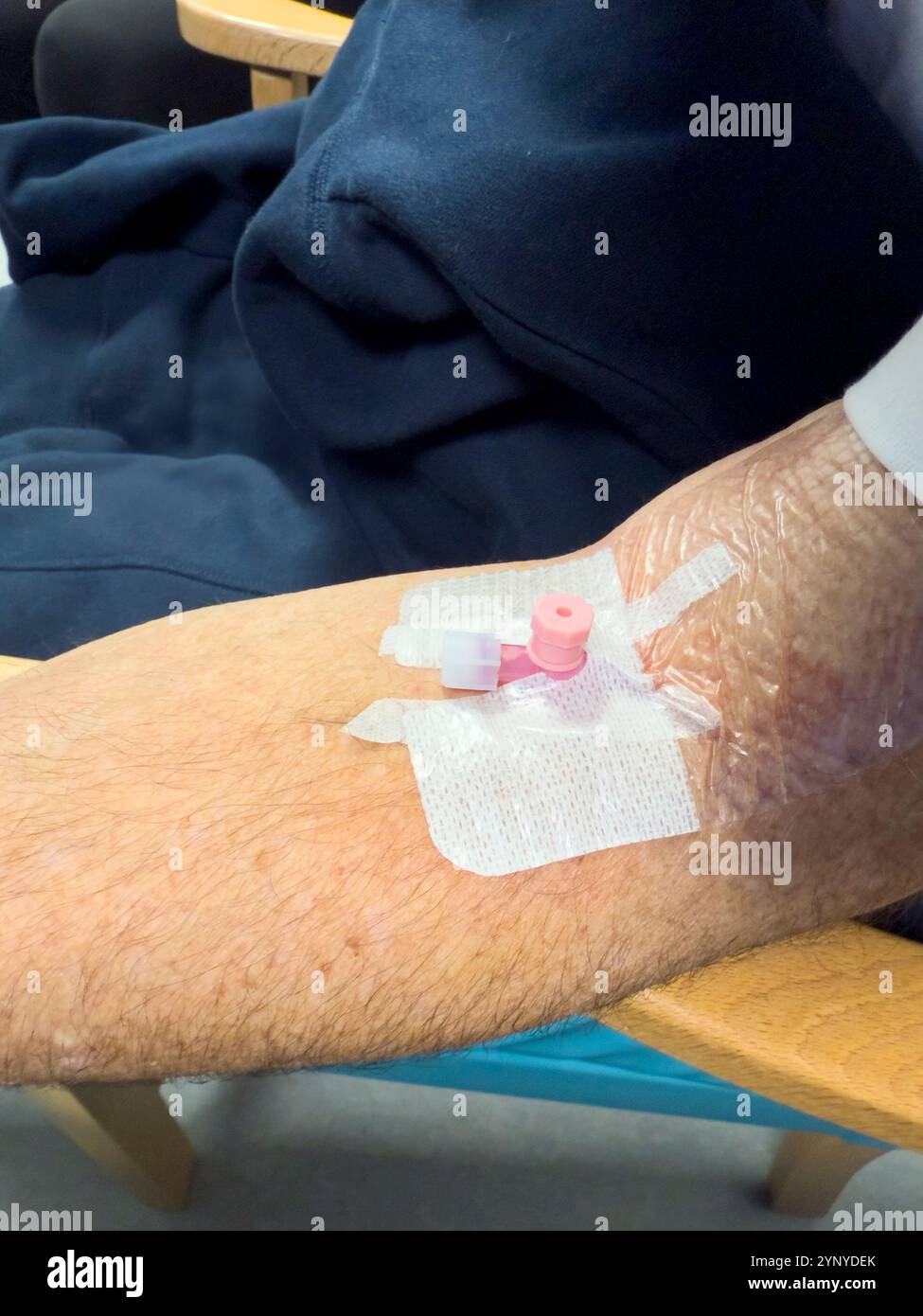 Eine Kanüle, die in den Arm eines älteren Mannes eingeführt wurde: Phillip Roberts - Smartphone-aufgenommenes Stockfoto