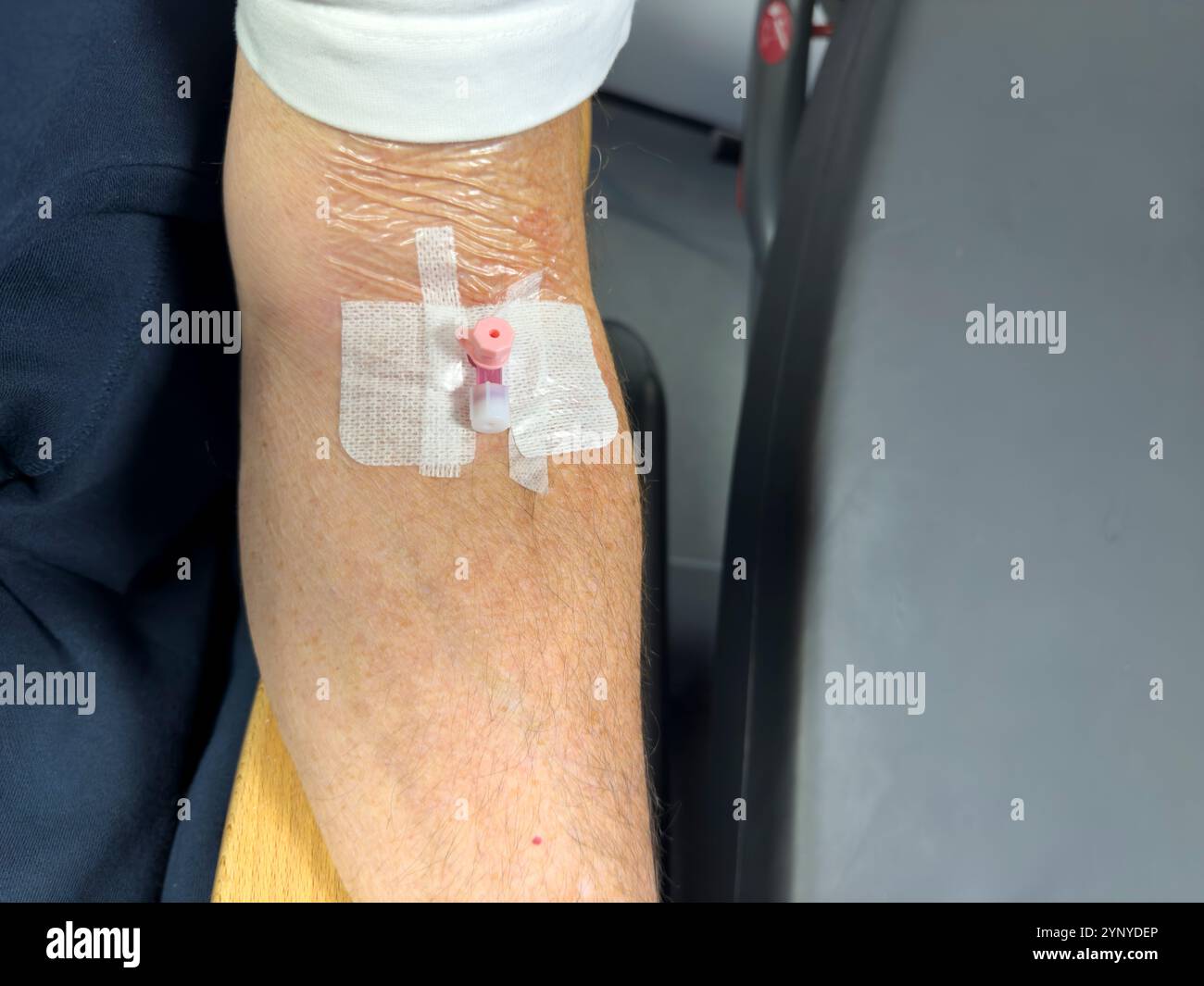 Eine Kanüle, die in den Arm eines älteren Mannes eingeführt wurde: Phillip Roberts - Smartphone-aufgenommenes Stockfoto