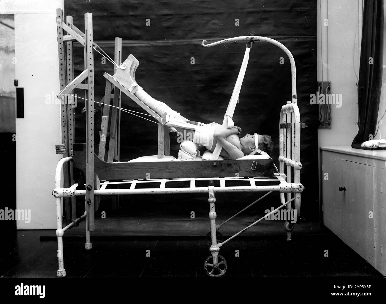 Kinder mit Rachitis behandelt mit Traktion in einem Sanitorium in Hampshire England im Jahr 1925 experimentelle Behandlung Medikamente Gesundheit Unterernährung schlechte Großbritannien britische Pflege Krankenschwestern 1930s Lichttherapie Lord Bürgermeister Treloar Krankenhaus Gesundheit, Gesundheit, Patient, Patienten, England, Englisch, Großbritannien Stockfoto