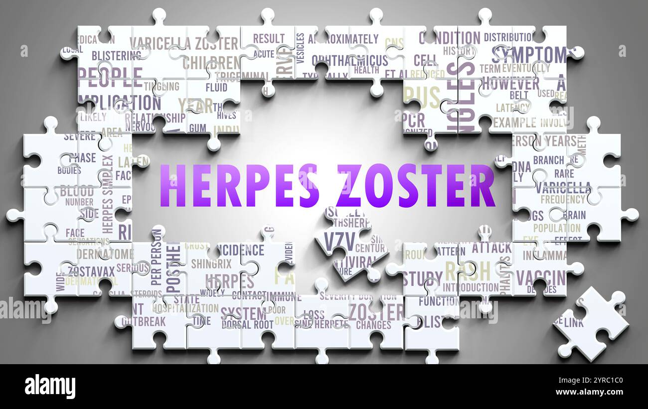 Herpes zoster ist ein komplexes Thema, das mit anderen wichtigen Themen zusammenhängt. Stockfoto