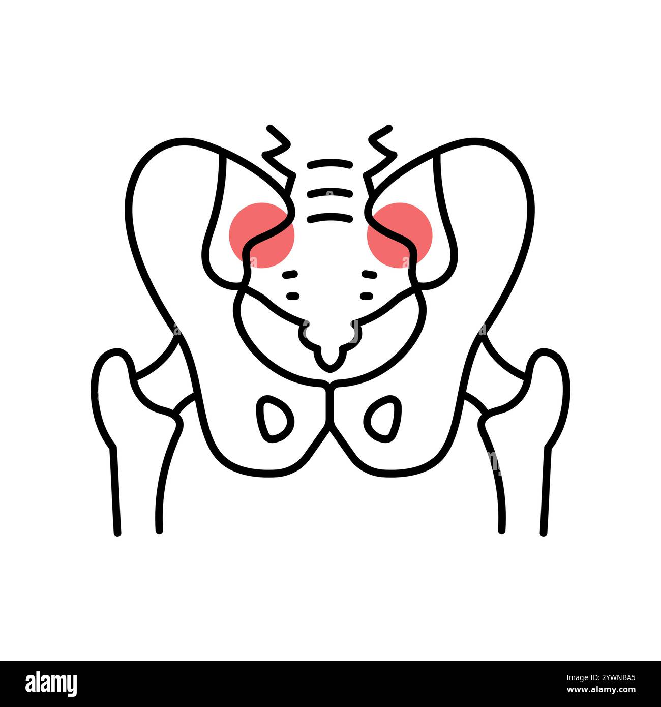 Sacroiliitis-Farblinien-Symbol. Erkrankungen der Wirbelsäule. Vertebrologie. Vektorisoliertes Element. Bearbeitbare Kontur. Stock Vektor