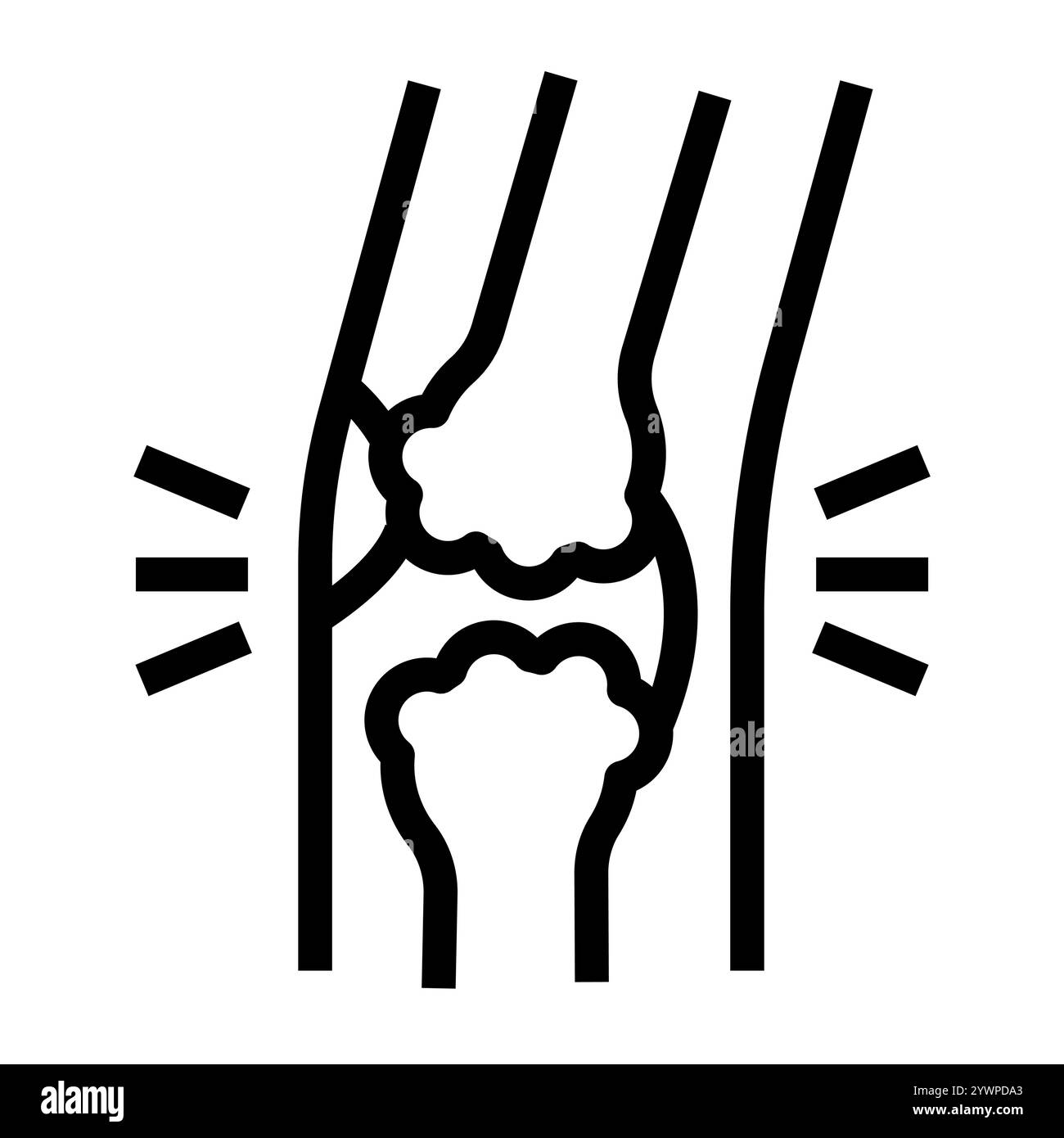 Schwarzes Symbol für die Zeile mit rheumatoider Arthritis. Schaltfläche Vektorisoliert. Bearbeitbare Kontur. Stock Vektor