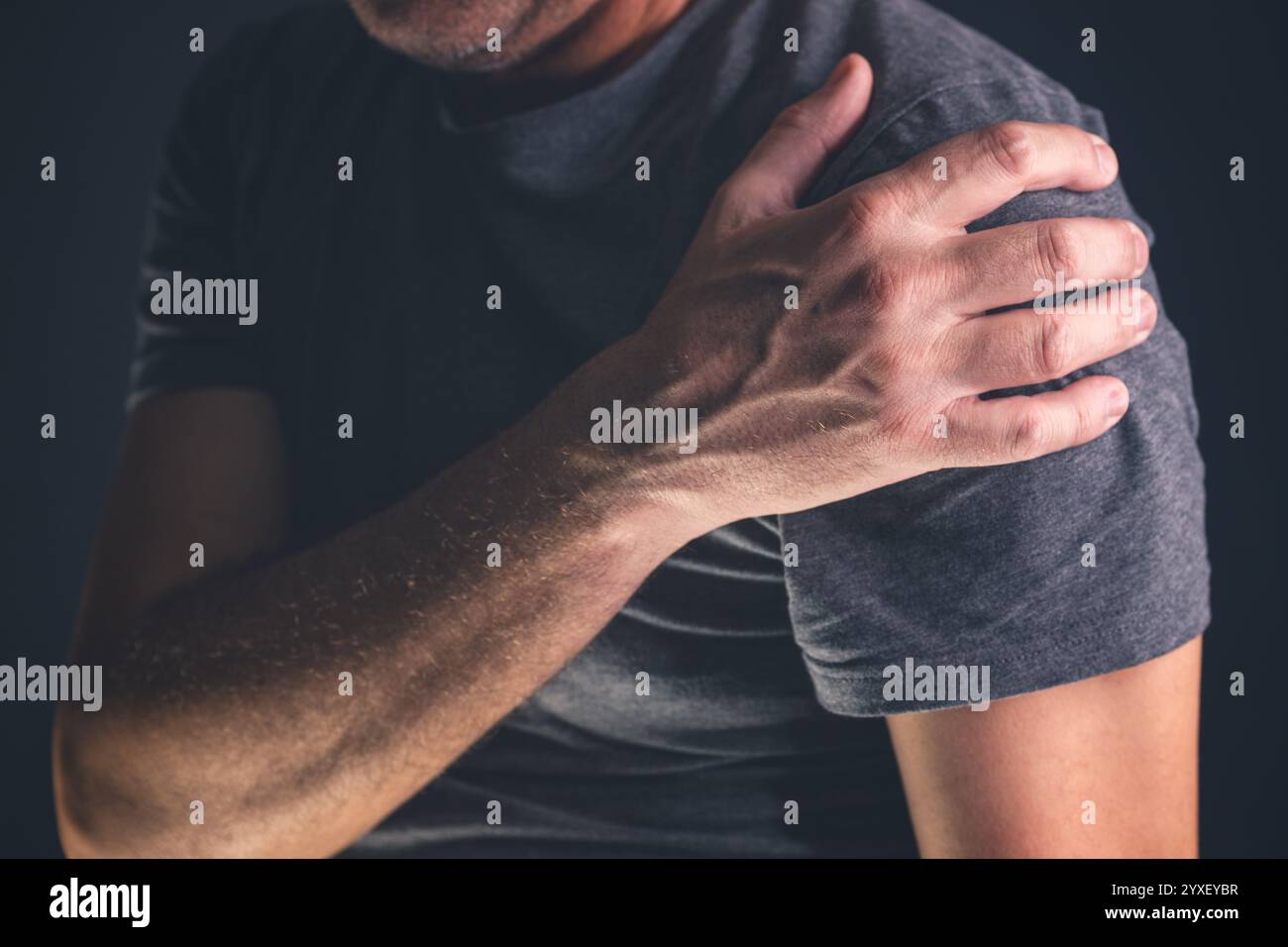 Schmerzende, gefrorene Schulterschmerzen als Symptom einer Rotatormanschettentendinitis, adulter kaukasischer Mann mit chronischer Bursitis, selektiver Fokus Stockfoto