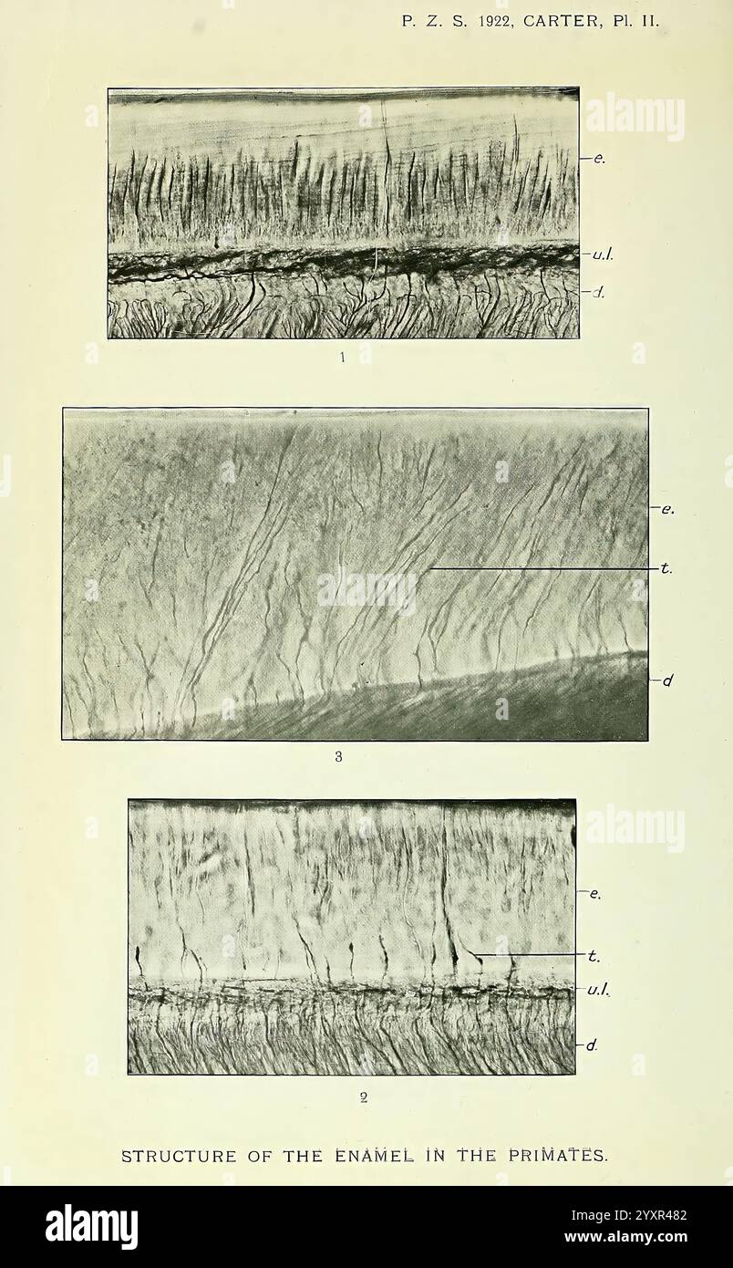 In dieser Illustration wird die Schmelzstruktur von Primaten detailliert untersucht, wobei drei verschiedene Abschnitte gezeigt werden. Jeder Abschnitt ist numerisch beschriftet und weist komplizierte Linien und Texturen auf, die die mikroskopische Architektur von Emaille darstellen. Im ersten Abschnitt wird die Ausrichtung der Emaille-Stäbe hervorgehoben, die durch Richtungspfeile angezeigt werden. Der zweite Abschnitt bietet einen genaueren Blick auf die Kristallite und ihre Anordnung. Der dritte Abschnitt konzentriert sich auf die zugrundeliegende Dentinstruktur, kontrastierend Stockfoto