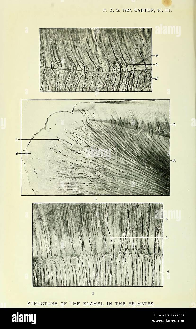 Das Bild zeigt eine Reihe detaillierter Illustrationen, die die Struktur des Schmelzes bei Primaten darstellen. Es besteht aus drei verschiedenen Abschnitten, die jeweils unterschiedliche Aspekte der Schmelz-Morphologie zeigen. Der erste Abschnitt hebt die Oberflächenstruktur und die Schichtung der Emaille hervor, die mit markierten Punkten als Referenz gekennzeichnet sind. Der zweite Abschnitt gibt einen genaueren Blick auf die Anordnung des Emails und betont die Feinheiten seiner Zusammensetzung. Im dritten Abschnitt werden die strukturellen Merkmale, illu, näher untersucht Stockfoto