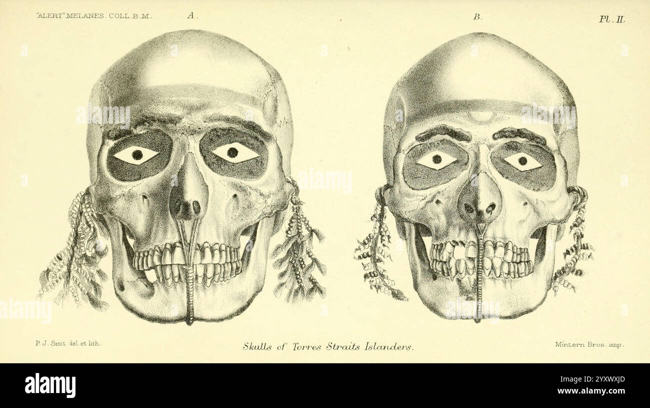 Bericht über die zoologischen Sammlungen im Indopazifischen Ozean während der Reise von H.M.S. 'Alert' 1881-2. London, 1884. Alert's Loop, 1856-1895, Australien, Inseln des Indischen Ozeans, Melanesien, Wissenschaftliche Expeditionen, Zoologie, Schädel, Schädel von Torres Straits Islanders, Torres Straits, Human Crania, Pierre Jacques Smit, 8, Pin, Seitenrechte, IG, Daily Sci Art, Homo sapiens., die Abbildung zeigt zwei detaillierte anatomische Darstellungen eines menschlichen Schädels mit der Bezeichnung A und B, die die Frontalansicht darstellen. Jeder Schädel wird aufwändig gerendert, wobei besondere Merkmale wie der Kubikkopf hervorgehoben werden Stockfoto