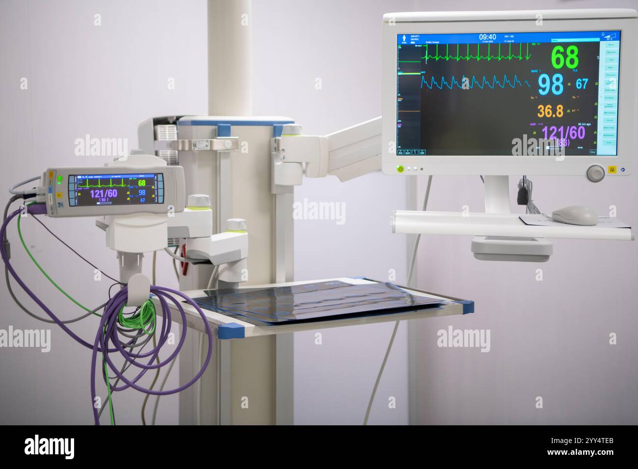 Moderne Technik in Intensivstationen mit verschiedenen Geräten und Geräten. Vitalparameter-Monitor. Institut für Neurochirurgie. Belgrad, Serbien Stockfoto
