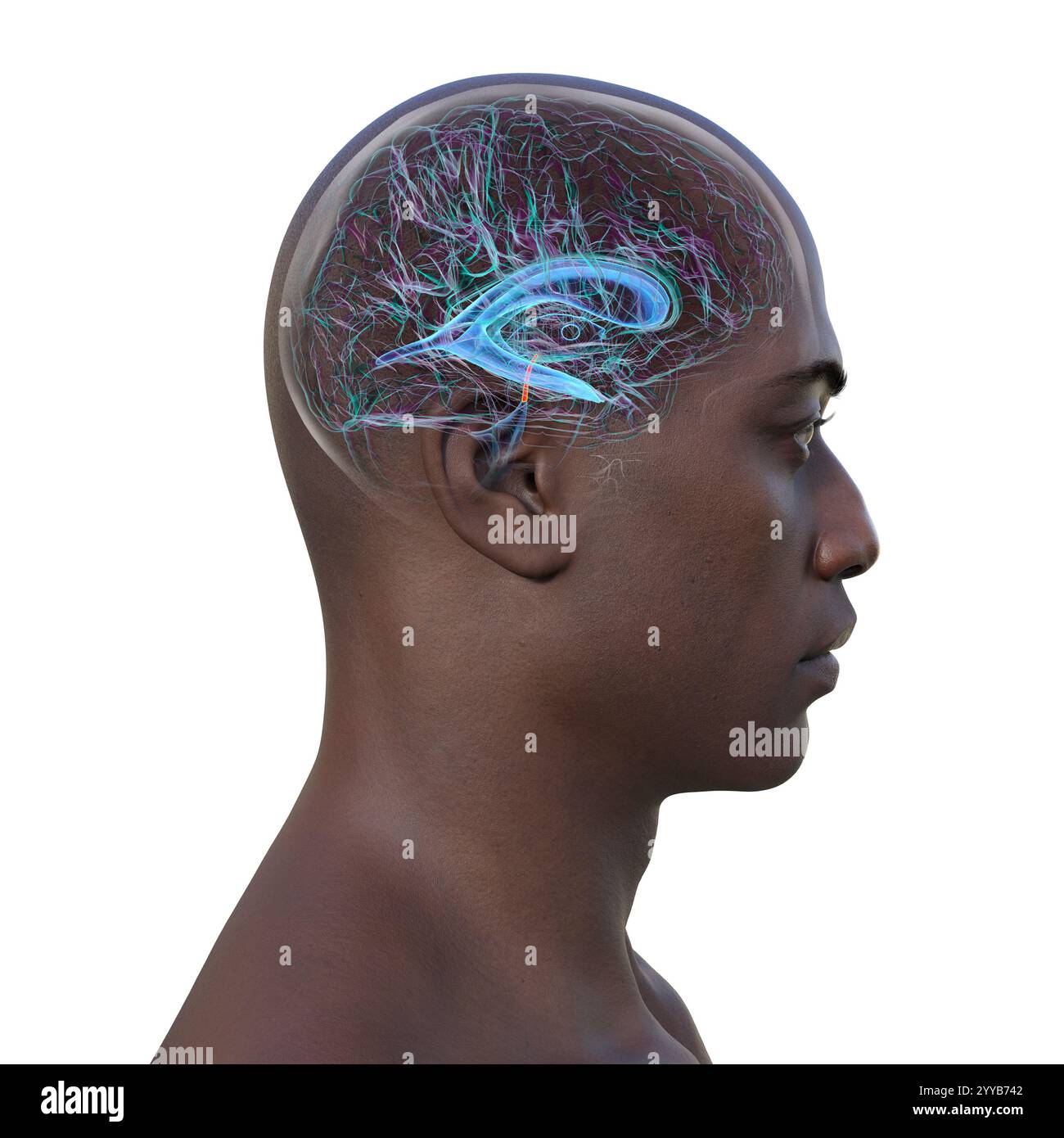 Computerdarstellung des menschlichen Gehirns mit orangefarbenem Aquädukt und grünem Ventrikelsystem mit Liquorfluss. Stockfoto