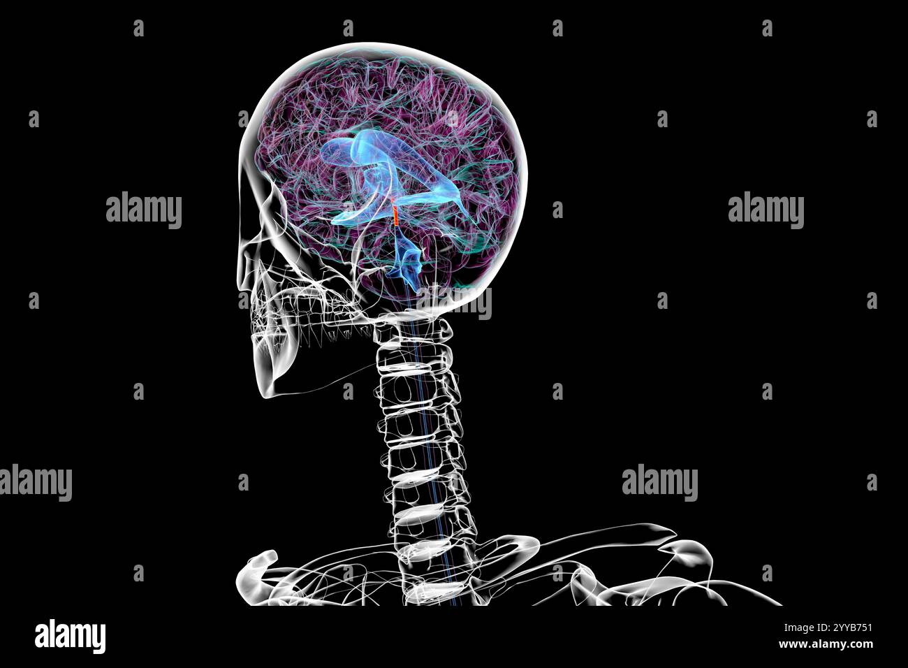 Computerdarstellung des cerebralen Aquädukts (orange), eines schmalen Kanals im Mittelhirn, der den dritten und vierten Ventrikel verbindet und den Liquorfluss erleichtert. Stockfoto