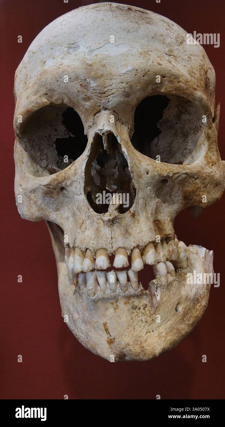 Ein mittelalterlicher Schädel im Winchester Museum Stockfoto