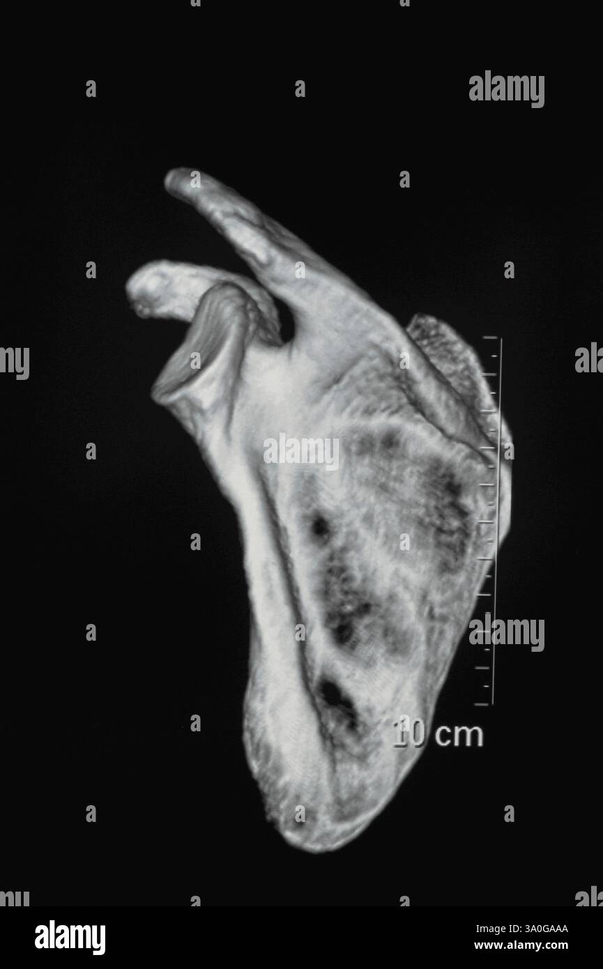 Human Bone CT-Bilder Stockfoto