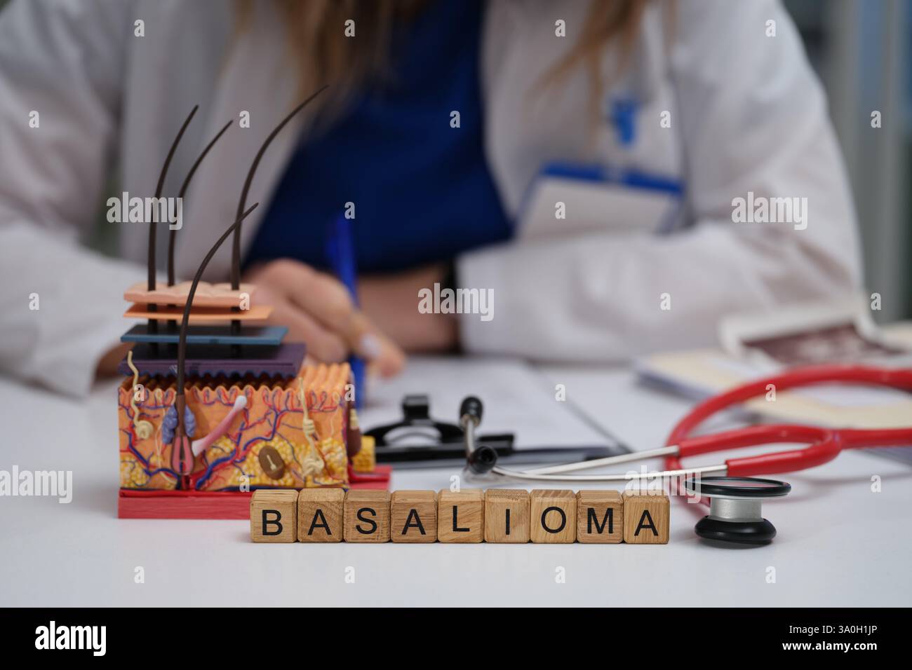 Ein umfassendes Verständnis des Basalzellkarzinoms in der medizinischen und klinischen Praxis Stockfoto